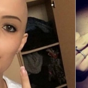 giorgia libero donazione midollo osseo
